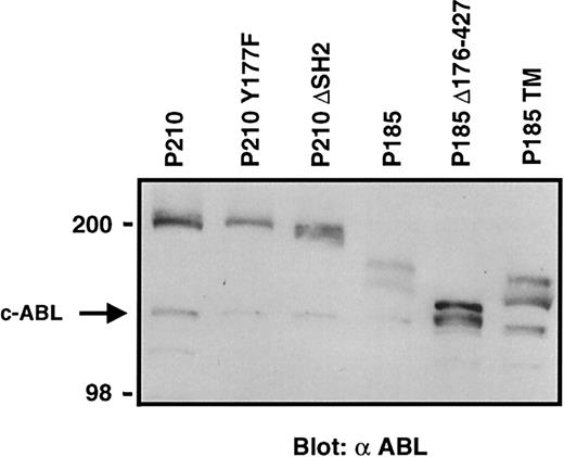 Fig. 6. Comparable protein expression in cells transduced with BCR-ABL mutant retroviral supernatants. / Western blot analysis of expression of BCR-ABL and its mutant in 3T3 cells infected with a 1-in-10 dilution of transducing retroviral particles used in experiments summarized in Table 2. The arrow indicates the endogenous c-ABL protein.