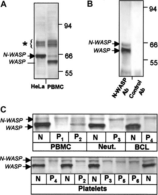 Fig. 1. Expression of WASP and N-WASP in human blood cells examined by Western blot. / Cell lysates were stained with N-WASP Ab-1. (A) HeLa cells and normal human PBMCs. Blots show WASP and N-WASP (low levels) in PBMCs. WASP is absent as anticipated in HeLa cells. Bands at 74 to 80 kd (∗) may represent proteins of the SCAR/WAVE family.1718 (B) Verification of N-WASP presence in normal platelets by immune precipitation. WASP and N-WASP were precipitated from normal platelet lysate by N-WASP Ab-2 and detected with N-WASP Ab-1. Normal rabbit IgG failed to precipitate detectable bands. (C) Blood cells and platelets from patients and control subjects. N-WASP was detected at similar levels in PBMCs, neutrophils (Neut), EBV-transformed B-cell lines (BCL) (upper panel), and platelets (lower panel) of various healthy control subjects (all indicated by N) and WAS patients (P1 to P6).
