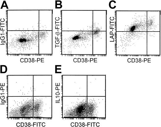 Fig. 7. Cytoplasmic expression of TGF-β1, LAP, and IL-10 in plasma cells. / Isotype controls (A, D). Low TGF-β1 (B), high LAP (C), and absent IL-10 expression (E) in plasma cells (CD38++) of a patient with myeloma.
