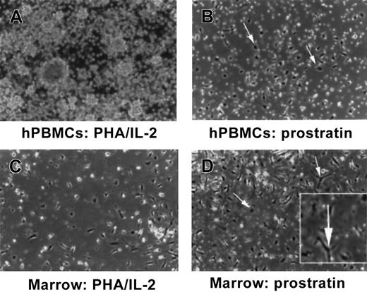 Fig. 1. Prostratin induces differentiation of peripheral blood and marrow mononuclear phagocytes. / Equivalent numbers (2 × 106 cells/mL) of human PBMCs or murine bone marrow cultures were plated and treated with PHA/IL-2 (A,C) or 0.263 μM prostratin (B,D). Numerous adherent mononuclear phagocytes of darkened and irregular flattened shape were apparent in both of the prostratin-treated cultures within hours following exposure to the compound (magnified inset, bottom right corner with select monocytes denoted by arrows). Cells were photographed 24 hours after treatment. These observations are representative of multiple experiments and microscopic fields.