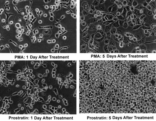 Fig. 3. Prostratin induces differentiation of the monocytic cell-line, THP-1. / THP-1, a suspension myeloid cell line, was treated with 0.3 μM PMA (A,B) or 0.3 μM prostratin (C,D). PMA-treated cells assumed the morphology typical of maturing macrophage 5 days after treatment as shown in panel B; prostratin-treated cells appeared to revert to a nonadherent phenotype as indicated in panel D. These observations are representative of 3 independent experiments.
