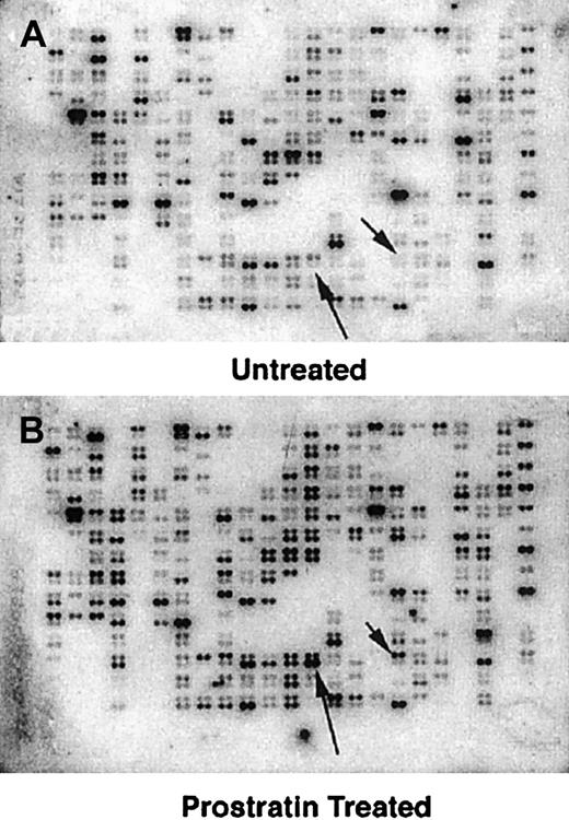 Fig. 5. Gene array analysis of prostratin-treated THP-1 cells. / Total RNA was isolated from untreated THP-1 cells or THP-1 cells exposed to 0.3 μM prostratin for 24 hours. Radiolabeled cDNA was synthesized for each RNA sample and hybridized to duplicate array filters. Images were captured by a phosphoimager analysis after overnight exposure and array values normalized as indicated in “Materials and methods.” Each horizontal doublet represents the positions of genes analyzed for expression level differences. Long arrows denote positions of IL-1β and short arrows denote positions for MMP-9 and are scribed to illustrate differences of the primary data as specific examples.