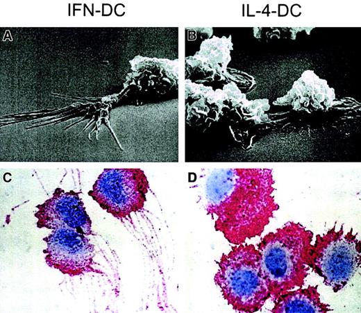 Fig. 2. Morphologic features of IFN-DCs. / Scanning electron microscopy analysis of IFN-DCs (A) showed a number of typical dendriticlike protrusions, not detected in IL-4-DCs (B), that were well adhering to the substrate. Immunocytochemistry for CD44 in IFN-DCs (C) and IL-4-DCs (D) (peroxidase-antiperoxidase method and hematoxylin counterstaining; magnification ×1500). Note the thin and long dendrites of IFN-DCs as compared with the squat dendrites of the IL-4-DCs. The CD44 staining is typically localized on dendrites, nicely outlining them.