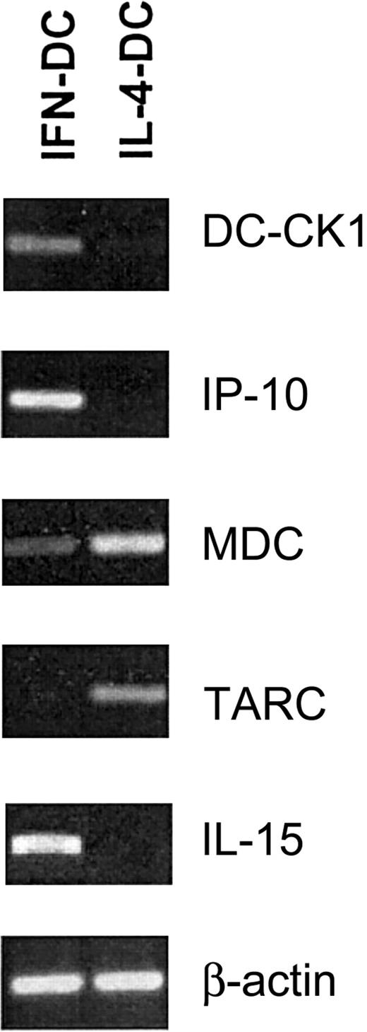 Fig. 4. Chemokine expression in IFN-DCs versus IL-4-DCs. / RT-PCR analysis showing expression of Th-1 and Th-2 chemokines in DC generated after a 3-day treatment of monocytes with either IFN/GM-CSF or IL-4/GM-CSF. Data are representative of 3 experiments performed with cells from different donors.