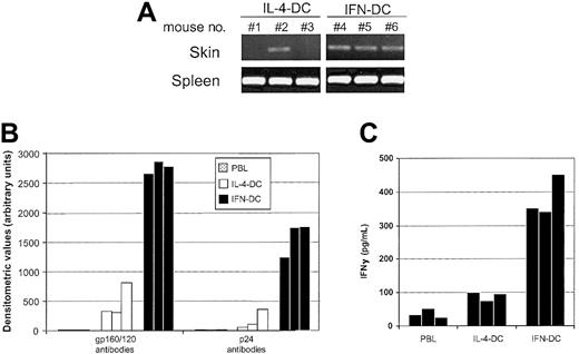 Fig. 6. IFN-DCs migrate with high efficiency in vivo and induce a potent antibody response toward the HIV-1 gp120/160 and p24 antigens along with a high production of human IFN-γ in hu-PBL-SCID mice. / (A) SCID mice were injected intravenously with 2 × 106IFN-DCs or IL-4-DCs. After 4 hours, the presence of human DNA sequences in the skin and spleen from each mouse was assessed as described in “Materials and methods.” Results of one representative experiment of 3 are shown. For each experiment, there were 3 mice per group. (B) Human antibodies against the HIV-1 gp120/160 and p24 proteins in the sera from hu-PBL-SCID mice immunized on day 0 and boosted on day 7 with 1.5 × 106 autologous DCs pulsed with AT-2-inactivated HIV-1. At days 14 and 21, mice were further boosted with AT-2-inactivated virus. Antibodies to the HIV-1 gp120/160 and p24 proteins were assessed as described in “Materials and methods.” Results represent the values detected in serum from individual mice killed at day 28. There were 3 mice for each group. (C) IFN-γ production in peritoneal washings of immunized and control hu-PBL-SCID mice was evaluated by using a specific enzyme-linked immunosorbent assay, as described in “Materials and methods.” In a previous set of 3 different experiments, the levels of human IFN-γ detected in the peritoneal washings of hu-PBL-SCID mice injected with unpulsed autologous DCs, under identical conditions, were never higher than those found in the peritoneal lavages of mice only injected with hu-PBLs (data not shown).