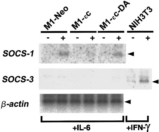 Fig. 1. Expression of SOCS mRNAs in M1-PTPε clones. / Total RNA was prepared from M1-stable clones cultured for 4 hours in the absence or presence of 25 ng/mL IL-6 and analyzed for expression of SOCS-1, SOCS-3, and β-actin mRNA by Northern blotting. RNA from NIH3T3 cells treated with 25 ng/mL IFN-γ was also analyzed for SOCS-3 expression as a positive control.