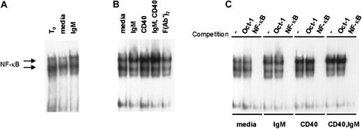 Fig. 4. IgM and CD40 engagement in CLL cells promote NF-κB activity in CLL cells. / (A) Nuclear extracts were prepared upon purification of the cells (t0), or after 4 hours of culture with media or anti-IgM, and evaluated by EMSA with a labeled probe for NF-κB binding activity. (B) Cells from another case were stimulated in culture for 4 hours prior to preparation of nuclear extracts and evaluation by EMSA. (C) To confirm the specificity of the signals for NF-κB activity, EMSA was performed using the extracts of panel B in the absence or presence of 50-fold molar excess of competitive, unlabeled Oct-1– or NF-κB–binding oligonucleotides.