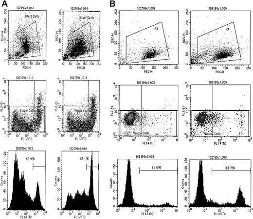 Fig. 3. TRAIL-induced apoptosis in MDS marrow. / TRAIL-induced apoptosis in aberrant MDS blasts (A) and in CD34+ precursors from MDS marrow (B). Panels in the left columns represent data before, and in the right columns, after TRAIL exposure. Shown are the gates used (top), scattergrams (middle), and DNA histograms (bottom) of gated cells. FSC indicates forward scatter; SSC, orthogonal scatter; FLI-FITC, fluorescence intensity after labeling with FITC-conjugated Annexin V; FL2-PI, fluorescence intensity after staining with propidium iodine; counts, relative number of cells. Percentage figures in the bottom panels indicate proportions of apoptotic cells.