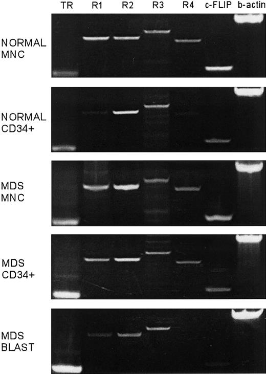 Fig. 5. Expression of TRAIL and TRAIL receptors R1-R4 mRNA in normal and in MDS marrow. / Shown are examples for total mononuclear cells (MNC) and CD34+ precursors, and separately, MDS blasts sorted on the basis of CD45 expression and orthogonal light scatter as described previously; β-actin served as internal standard.522