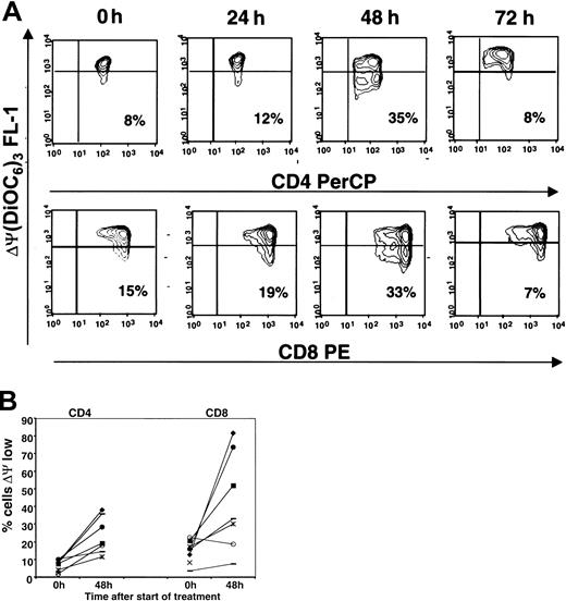 Fig. 4. Induction of mitochondrial membrane permeability transition in CD4 and CD8 T cells by in vivo chemotherapy. / Patients' CD4 and CD8 lymphocytes were analyzed by flow cytometry for lowered uptake of DiOC6(3) indicating inner mitochondrial membrane permeability transition. (A) Contour plots of a representative analysis (patient A10). Fifty thousand cells were acquired in the lymphoid gate. Gating for CD4 and CD8 was performed in the side scatter versus fluorescence plots. Percentages represent the proportion of cells with low mitochondrial membrane potential. (B) For patients A3 to A10, the number of cells with low mitochondrial membrane potential (ΔΨ low) was assessed. The graph depicts pretreatment values (0 hour) and values after 48 hours of chemotherapy for individual patients.