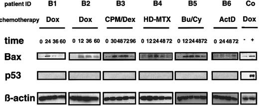 Fig. 5. Protein expression of p53 and Bax during chemotherapy. / Mononuclear cells from patients undergoing chemotherapy were isolated at different time points of treatment, as indicated. Shep cells not stimulated or stimulated with doxorubicin 1 μg/mL for 24 hours served as a positive control. Bax and p53 protein were detected by immunoblot. Actin served as control for the equal loading of protein.