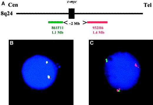 Fig. 1. Configuration of the c-myc probes. / (A) Schematic representation of the 2 YAC probes used in this study (figure is not drawn to scale). (B) A typical plasma cell nucleus lacking any c-myctranslocation: both probes are fused on each allele. (C) Plasma cell nucleus showing a c-myc translocation. One allele is normal (represented by the probe fusion), whereas the second allele is translocated: the green probe remained on the der(8), and the red probe was translocated on the partner chromosome.