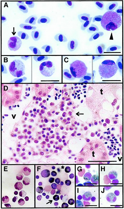 Fig. 1. Light microscope appearance of adult zebrafish granulocytes. / (A) A heterophil (black arrow) and an eosinophil (arrowhead) in a single field of a May-Grünwald-Giemsa–stained zebrafish blood smear. (B) Detail of mature heterophils with double- and triple-lobed nuclei (May-Grünwald-Giemsa–stained blood smear). (C) Detail of mature eosinophils, illustrating characteristic pink cytoplasm and peripheral nucleus (May-Grünwald-Giemsa–stained blood smear). (D) Hematoxylin and eosin section of posterior kidney showing an interstitial niche of myelopoiesis lying between renal tubules (t) and blood vessels (v), including several heterophil granulocytes recognizable by their indented or segmented nuclei (arrow). (E-J) Myeloperoxidase histochemical staining of cytospin preparations of single-cell suspensions prepared from adult zebrafish kidneys. Giemsa-stained preparation (E) showing mature heterophil granulocytes serving as negative control for (F), which was stained histochemically for myeloperoxidase and counterstained with Giemsa (to display nuclear morphology), showing myeloperoxidase-positive cells with black cytoplasmic staining at various stages of heterophil development (eg, arrow). *Erythrocyte with weakly peroxidase-staining gray cytoplasm. Myeloperoxidase-positive heterophil granulocytes of various stages of development: promyelocyte (G), myelocyte (H), metamyelocyte (I), and segmented mature form (J). Myeloperoxidase positivity is strongest at the myelocyte and metamyelocyte stages of development. Scale bar = 10 μm in all panels except D, where it equals 24 μm.