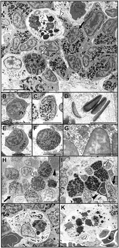 Fig. 2. Electron microscope appearance of adult zebrafish granulocytes and macrophages. / (A) Electron micrograph overview of hematopoietic area of adult posterior zebrafish kidney, illustrating heterophil granulocytes (eg, black arrow) as the most prevalent cell, a rarer eosinophil granulocyte (white arrow), and a macrophage (white arrowhead) containing numerous cytoplasmic phagosomes including electron-dense material of similar appearance to erythrocyte cytoplasm. (B-D) Electron microscope appearance of zebrafish heterophil granulocytes. (B) Immature heterophil promyelocyte with large nucleus and few electron-dense, cigar-shaped cytoplasmic granules. (C) Heterophil metamyelocyte with cytoplasm densely packed with electron-dense granules and peripheral nonsegmented nucleus. (D) Higher-power view of the cigar-shaped, electron-dense heterophil granulocyte cytoplasmic granules, showing their axial electron-denser lamellations. (E-G) Electron microscope appearance of zebrafish eosinophil granulocytes. (E) Immature eosinophil promyelocyte with large nucleus and few round cytoplasmic granules of variable electron density. (F) Eosinophil metamyelocyte with cytoplasm densely packed with round and oval-shaped granules and peripheral nonsegmented nucleus. (G) Higher-power view of the characteristic granules of eosinophils, larger than heterophil granules (D) and with marbled variable electron density. (H, I) Electron micrograph incubated for peroxidase (I) and negative control (H) showing the peroxidase reactivity of eosinophil granules (white arrow), evidenced by their darker color in panel I than in panel H, and erythrocyte cytoplasm (black triangle) under conditions of this stain. The already electron-dense heterophil granules (black arrow) are not discernibly darker under the peroxidase reaction conditions. (J, K) Macrophage in kidney (J) and spleen (K) of adult zebrafish, with phagosomes suggestive of erythrophagocytosis. Scale bar = 5 μm in all panels except D and G, where it equals 0.5 μm.