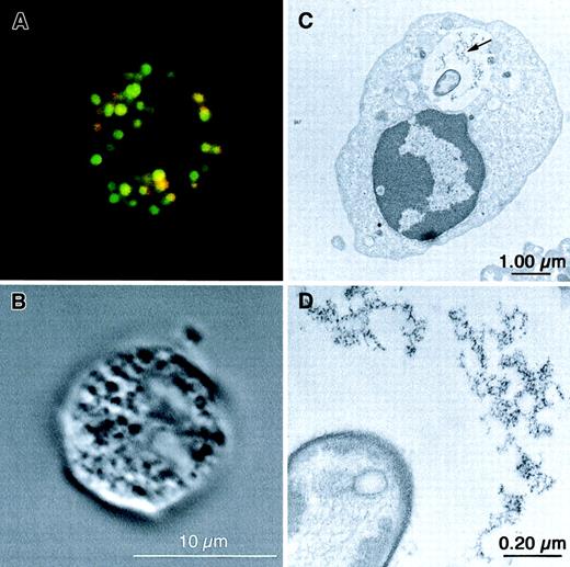 Fig. 2. Localization of liposomes and. / S aureus in granulocytes by confocal laser microscopy and electron microscopy. (A) Confocal laser microscopy. Granulocytes (1 × 106/mL) were incubated at 37°C for 15 minutes with 10 × 106 BODIPY-labeled (green) S aureus particles, followed by an incubation with 1 mM rhodamine-B-PE–labeled (red) liposomes (EPC:EPG:Chol, 4:3:3 mole ratio) for 20 minutes. Colocalization of S aureusand liposomes is suggested in several vacuoles appearing yellow (red-green overlay). (B) Confocal laser microscopy. Same granulocyte visualized by differential interference contrast (DIC) microscopy. (C) Electron microscopy. Isolated normal granulocytes (15 × 106/mL) were incubated with 15 × 107 S aureus particles and 3 mM ferritin-containing liposomes (EPC:EPG:Chol, 4:3:3 mole ratio) at 37°C for 60 minutes. The arrow indicates the ferritin particles derived from liposomes. (D) Higher magnification of the ferritin-containing vacuole of the same cell as in panel C.