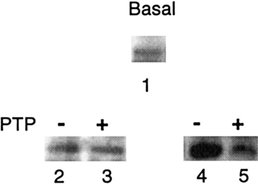 Fig. 5. Effect of membrane PTP on Syk activity. / The phosphorylation state of Syk ICs was analyzed by antiphosphotyrosine immunoblotting under various conditions: IC from unincubated SS cells (lane 1); IC after incubation with membrane suspensions, either with Na3VO4 (inhibited PTP, −) (lane 2), or in its absence (active PTP, +) (lane 3); IC after preincubation with inhibited PTP (−) or active PTP (+) followed by IC assays (lanes 4 and 5, respectively). One representative experiment is shown. Similar data were obtained in 3 other experiments with SS cells and in 2 experiments with AA cells.