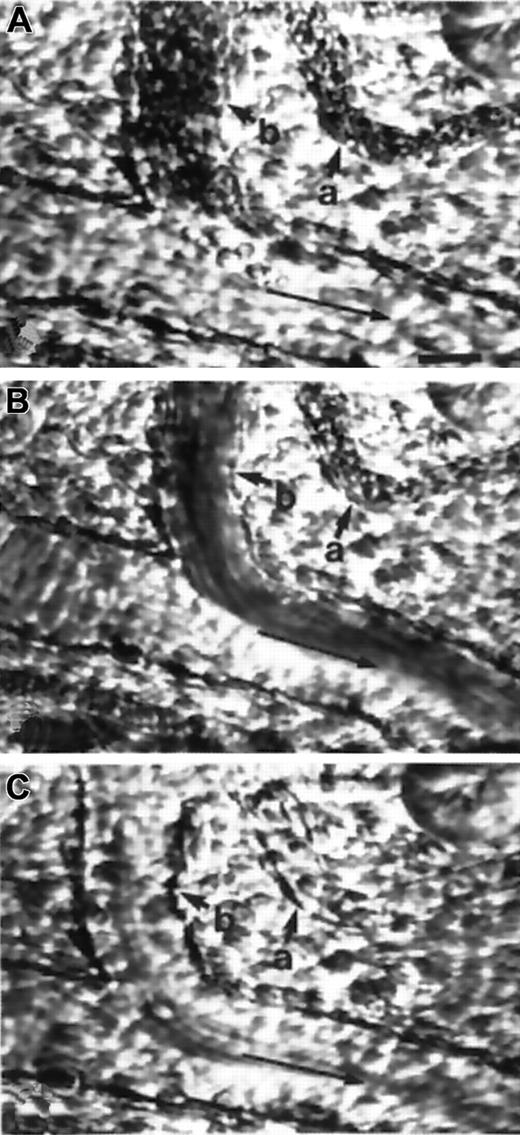 Fig. 2. Video micrographs of mesocecum microvasculature. / (A) Obstruction in postcapillary venules (a, b) after the infusion of deoxygenated SS RBCs in a PAF-treated preparation. (B) After the infusion of oxygenated PFE, there is dislodgement of trapped SS RBCs from the venule (a). (C) This was followed by the complete clearance of trapped cells from both postcapillary venules (a, b). Large arrows indicate the flow direction. Bar, 20 μm (A).
