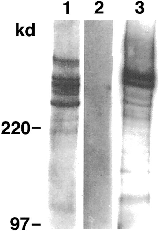 Fig. 1. PfEMP1 is present on membrane extracts of infected but not normal erythrocytes. / Western blot analysis of SDS extracts of P98-23 (lane 1), noninfected erythrocytes (lane 2), and D10 (lane 3) by anti-ATS. Bands of approximately 220 kd and above were seen only in the extracts from infected erythrocytes.