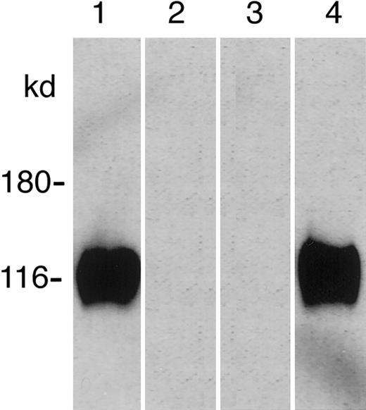 Fig. 2. Affinity purification of recombinant human P-selectin (rhP-selectin) with immobilized PfEMP1. / Soluble rhP-selectin was incubated with bead-immobilized PfEMP1. Binding of rhP-selectin was detected by western blotting (lane 1), and the solubilized protein comigrated with rhP-selectin (lane 4). No band was seen with the extracts from the noninteracting parasite line D10 (lane 2) or noninfected erythrocytes (lane 3).