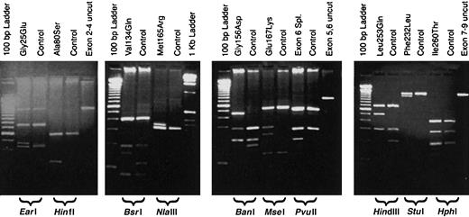 Fig. 1. Restriction digestion patterns of PCR products detect mutations in the. / URO-D gene. Genomic DNA from probands and controls was PCR amplified, digested with a restriction enzyme, and separated on a 2% agarose gel. Lanes are marked as either mutant or control (above), and the restriction enzyme used is indicated below the gel. A lane containing an undigested PCR product (control) is also included. Molecular markers are present on the outside lanes of each gel.