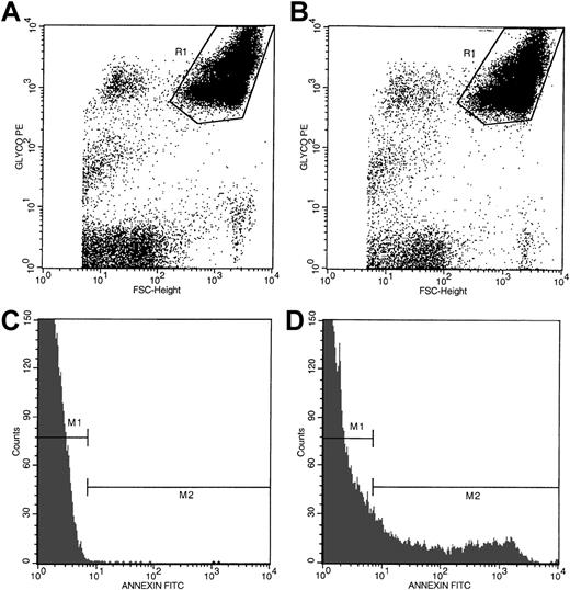 Fig. 1. Flow cytometric analyses of PS-positive erythrocytes in whole blood from a representative patient with SCD. / Dot plots of forward size scatter verses anti-CD235a–PE fluorescence from a blood sample stained in the presence of EDTA and calcium are presented in panels A and B, respectively. Region R1 in these dot plots represents red cell–associated events. Histogram profiles of annexin V–FITC fluorescence of erythrocytes stained in the presence of EDTA and calcium are presented in panels C and D, respectively. Annexin V–negative (gate M1) and –positive (gate M2) histogram regions were set by using the blood sample stained in the presence of EDTA as shown in panel C. The histogram profile presented in panel D demonstrates the presence of a distinct subpopulation of PS-positive erythrocytes (gate M2).