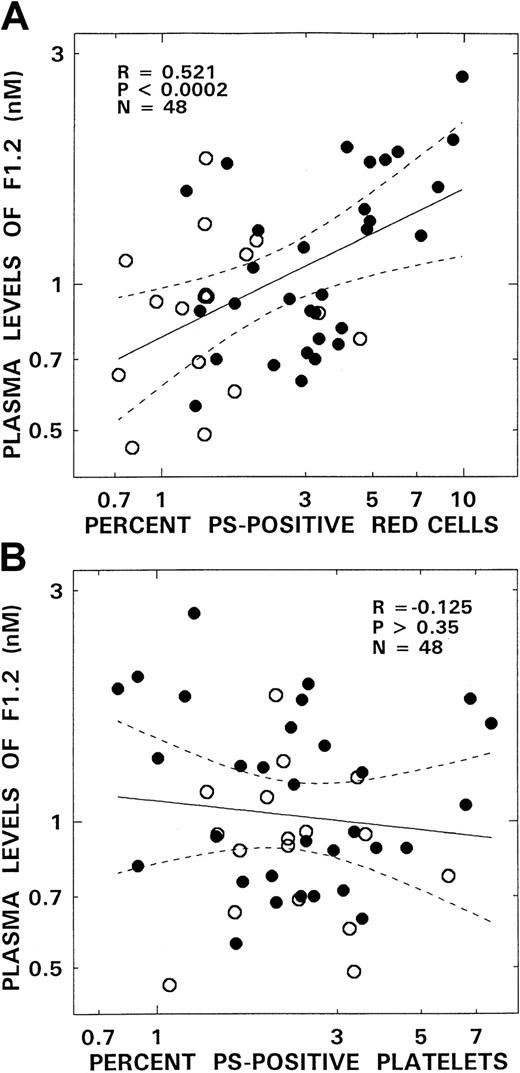 Fig. 4. Relationship between plasma levels of F1.2 and PS-positive red blood cells and PS-positive platelets from patients with SCD. / Panel A depicts the association between the levels of F1.2 and PS-positive red blood cells. Panel B presents correlation between F1.2 and PS-positive platelets. The open and closed circles represent data points from patients with the SC and SS genotypes, respectively. The solid lines represent the linear-regression fit to the data, and the dotted lines represent the 99% confidence interval curves.