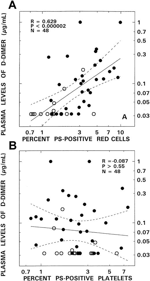 Fig. 5. Relationship between D-dimer and PS-positive red blood cells and PS-positive platelets from patients with SCD. / Panel A depicts the association between the levels of D-dimer and PS-positive red blood cells. Panel B presents correlation between D-dimer and PS-positive platelets. The open and closed circles represent data points from patients with the SC and SS genotypes, respectively. The solid lines represent the linear-regression fit to the data, and the dotted lines represent the 99% confidence interval curves.