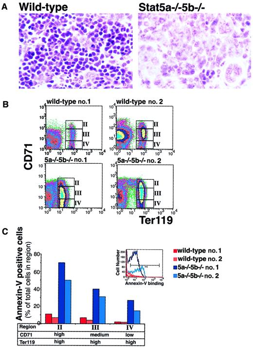 Fig. 8. Increased apoptosis in Stat5a−/−5b−/−neonatal spleens. / (A) Hematoxylin and eosin-stained sections of neonatal spleen from either wild-type or Stat5a−/−5b−/− mice. Original magnification at the time of photography was × 250. (B) Flow cytometry density plots of wild-type and Stat5a−/−5b−/−neonatal spleen cells simultaneously labeled for Ter119, CD71, and annexin V binding. Regions II to IV are indicated and correspond to the analysis of annexin V binding on these cells shown in panel C. Ter119 expression was variably reduced in Stat5a−/−5b−/− spleens. In the representative plots shown, the geometric mean fluorescence for Ter119 in the Ter119-positive populations is 73 and 68 for wild-type spleens 1 and 2, and 14 and 50 for Stat5a−/−5b−/−spleens 1 and 2, respectively. (C) Annexin V binding of Ter119high erythroblasts in regions II to IV for the spleen cells analyzed in panel B. Inset shows an example of annexin V binding histogram for region II. Cells within the marker M1′ were considered annexin V–postiive.