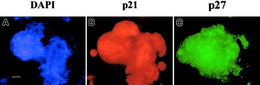 Fig. 5. The p53-independent expression of p21 and p27 in megakaryocytes. / Megakaryocytes were obtained from p53−/−lin− murine cells cultured for 4 days with SCF and PEG-rHu MGDF. Double immunostaining was performed with mouse anti-p21 and rabbit anti-p27 antibodies followed by incubation with donkey TRITC antimouse and FITC antirabbit F(ab′)2 fragments, respectively. Nuclei were counterstained with DAPI. Bar, 10 μm. More than 500 megakaryocytes were examined in 3 experiments.