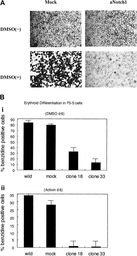 Fig. 1. Inhibition of erythroid differentiation by aNotch1 in F5-5 cells. / (A) F5-5 cells were infected with mock virus or aNotch1-containing pMX/IRES-EGFPpuro virus. The morphology of clone 33 and a control clone 6 days after the induction for differentiation is demonstrated with 1.5% DMSO or Activin A. Cells were stained with benzidine. Original magnification × 200. (B) Erythroid differentiation was evaluated by the ratio of benzidine-positive cells. Cells were differentiated by DMSO (i) or Activin A (ii). After 6 days, the ratio of benzidine-positive cells was calculated. The results show the mean values of 3 independent experiments and the error bars show SD.