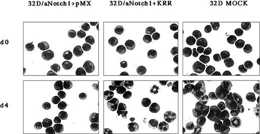 Fig. 3. Reversal by DN-GATA of the effect of aNotch1 on the granulocytic differentiation in 32D cells. / Activated Notch1-expressing 32D cells were infected with a mock virus or a DN-GATA–containing pMX/IRES-EGFPpuro virus. The cells are shown stained with Wright-Giemsa stain 4 days after the addition of G-CSF. Original magnification × 400. Three independent DN-GATA–expressing clones and control clones derived from 2 independent aNotch1-expressing clones were investigated.