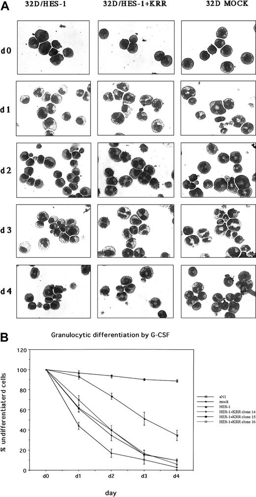 Fig. 4. Delay of granulocytic differentiation by HES-1 in 32D cells and abolishment of this phenotype by DN-GATA. / The original 32D cells were transfected with the SRα promoter-driven HES-1 cDNA and selected for G418. Some G418-resistant clones were further infected with a mock virus or a DN-GATA–containing pMX/IRES-EGFPpuro virus. The morphology of the cells 4 days after the addition of G-CSF is shown in panel A (Wright-Giemsa staining). Original magnification × 400. Three independent DN-GATA–expressing clones derived from each of 2 independent HES-1–expressing clones were investigated. (B) The ratio of undifferentiated cells after successive days of culture is shown. The results are expressed as the mean values of 3 independent experiments, with error bars showing SD.