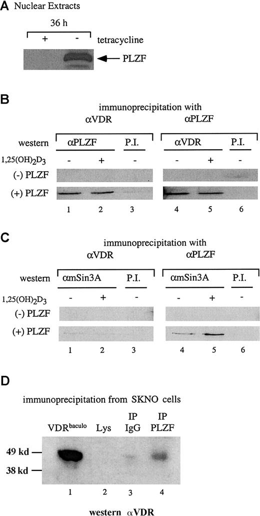 Fig. 2. VDR and PLZF interact in U937 nuclear extracts. / (A) Immunoblot for expression of PLZF in nuclear extracts. Nuclear extracts from the tetracycline-regulated stable line U937-PLZF45 were prepared from cells grown for 36 hours in the presence (− PLZF) or absence (+ PLZF) of tetracycline and immunoblotted for PLZF expression by using an anti-PLZF monoclonal antibody. (B) Coimmunoprecipitation of PLZF and VDR from nuclear extracts. Immunoprecipitations were done by using nuclear extracts from U937-PLZF45 cells with either anti-VDR or anti-PLZF monoclonal antibodies and protein A/G agarose. Precipitated complexes were washed in propidium iodide buffer containing 200 mM KCl, separated by SDS-PAGE, and immunoblotted for either PLZF (lanes 1-3) or VDR (lanes 4-6). Preimmune serum and protein A/G beads were used as a negative control immunoprecipitation (lanes 3 and 6). (C) Coimmunoprecipitation of PLZF and mSin3A. Antibodies directed against PLZF (lanes 4 and 5) but not those against VDR (lanes 1 and 2) coimmunoprecipitated Sin3A from PLZF45 extracts. Coimmunoprecipitation was performed as in panel B, except that the complexes were immunoblotted for mSin3A with an antibody that cross-reacts with human Sin3A. Preimmune serum and protein A/G beads were used as a control (lanes 3 and 6). (D) Coimmunoprecipitation of PLZF and VDR in SKNO cells. Lysates of these cells were subjected to direct immunoblotting (lane 2) or blotting after precipitation with PLZF antibody (lane 4) or an isotype control (lane 3). A positive control (lane 1), confirming the efficacy of the antibody and size of the precipitated species, consisted of 25 ng purified baculovirus-derived VDR (VDRbaculo). Direct immunoblotting was done with 100 μg lysate from SKNO-1 cells. PI indicates preimmune serum; IP, immunoprecipitation; Lys, lysate.