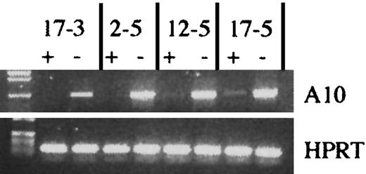 Fig. 3. Induction of transgenic HOXA10 expression in vitro. / Induction of HOXA10 transgene expression in 4 different transgenic mouse lines. tetO-HOXA10 BM cells were transduced with the NIT-GFP vector and then grown in selective medium in the presence (+) or absence (−) of doxycycline (2 μg/mL) for 5 days. RT-PCR was performed on RNA isolated from cultured cells using the A10 and BG primers amplifying a 950-bp band. For RNA/DNA control, HPRT primers were used. PCR was also performed on isolated RNA to verify the absence of genomic DNA contamination (data not shown).