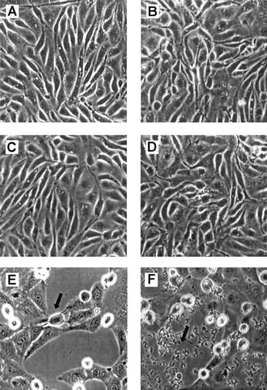 Fig. 2. Redox cycling of DBBF-Hb by glucose oxidase leads to morphologic changes in endothelial cells. / Endothelial cells were incubated with FBS-free medium alone (A, B), 10 mU/mL GOX (C, D) or 50 μM DBBF-Hb and 10 mU/mL GOX (E, F). Cells were viewed by phase-contrast microscopy and photographed (×20 objective). Photomicrographs were taken after 8 (left panels) and 20 (right panels) hours. (E) Detached cells out of the plane of focus appear bright. Arrow indicates a cell in the process of rounding and detaching. (F) Arrow points to cellular debris.