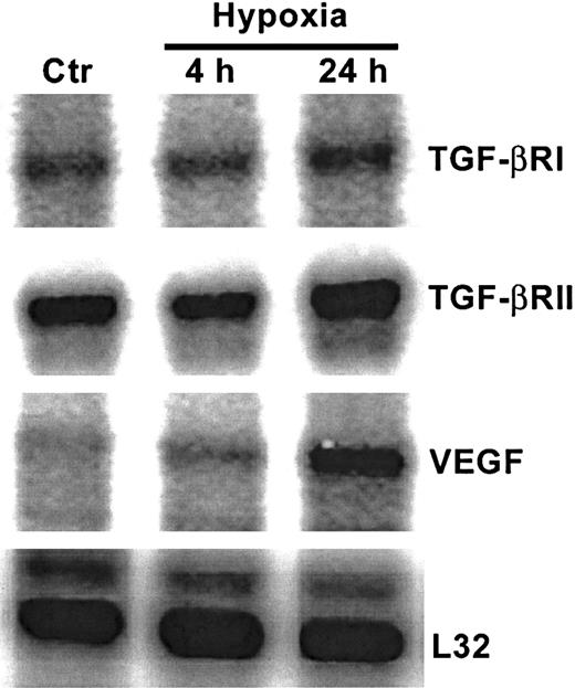 Fig. 2. Effect of hypoxia on serine threonine kinase TGF-β receptor mRNA levels. / RNase protection analysis of mRNA extracted from HUVECs after exposure to 20% O2 or 1% O2 at indicated times. Control represents mRNA from normoxic HUVECs. Each lane contained 10 μg total RNA hybridized to the antisense RNA probe cocktail. Results are from a single gel in which lanes are separated for display purposes.