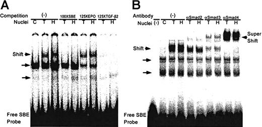 Fig. 7. Hypoxia induces sequence-specific DNA binding activity by Smads. / (A) Electrophoretic gel mobility shift assays were performed using a32P-labeled SBE probe as described in “Materials and methods.” Nuclear extracts were as follows: control normoxic HUVECs, C; HUVECs treated for 30 minutes with 12.5 ng/ml TGF-β2, T; or HUVECs exposed to hypoxia (1% O2) for 4 hours, H. Competition assays: no competition (−); 100-fold molar excess of unlabeled SBE (100 × SBE); 125-fold molar excess of erythropoietin (125 × EPO), an HIF-1–containing oligonucleotide; 125-fold molar excess of an oligonucleotide that corresponds to the −77 to −40 bp TGF-β2 promoter (125 × TGF-β2). (B) Antibody supershifting: nuclear extracts from HUVECs were preincubated with anti-Smad2, anti-Smad3, or anti-Smad4 antibodies for 30 minutes prior to the binding reaction. Constitutive binding is indicated by the unlabeled arrows.