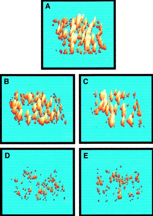 Fig. 6. Three-dimensional representations of platelet deposition from whole blood onto vWf–collagen 1 after 60 seconds of perfusion at 3000 s−1. / Images were acquired in the presence of (A) saline (control), (B) 0.5 μM ARMX, (C) 10 μM A3P5P, (D) 5 μg/mL abciximab, and (E) 0.5 μM ARMX + 10 μM A3P5P. Images were digitized, and 3-dimensional structures were inferred from their 2-dimensional structures. Fluorescence intensity is proportional to the platelet number; therefore, the height of the thrombus is proportional to the intensity of the image at any point within the thrombus.28