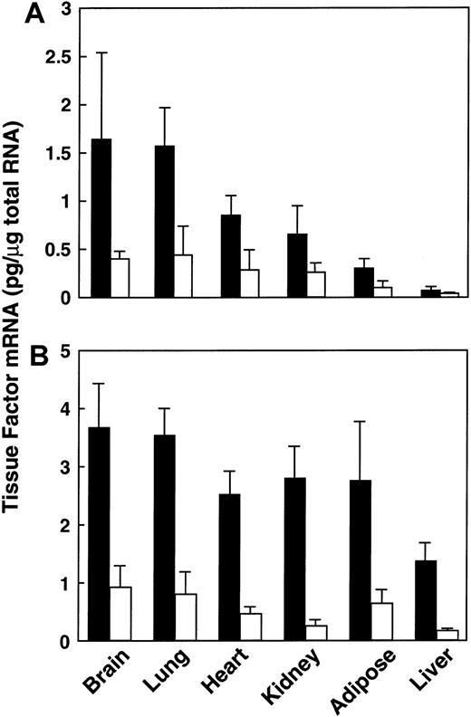 Fig. 1. Expression of TF mRNA in tissues from lean and obese mice. / Total RNA was extracted from various tissues of male lean (■) and obese (▪) animals at 3 months of age. TF mRNA was determined using quantitative RT-PCR analysis, as described in “Materials and methods.” For each condition, n = 6, mean ± SD. (A) Lean versus ob/ob mice. (B) Lean versus db/db mice.