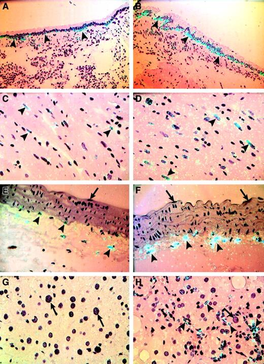 Fig. 2. Cellular distribution of TF mRNA in tissues from lean and obese (ob/ob) mice. / In situ hybridization was performed on sections of paraffin-embedded tissues from lean mice (A,C,E,G) and obese mice (B,D,F,H) using35S-labeled TF riboprobes, as described in “Materials and methods.” Representative sections are shown. (A,B) Lung; (C,D) heart; (E,F) aorta; (G,H) liver. Arrowheads indicate examples of positive hybridization signals, and arrows indicate the absence of a hybridization signal. Slides were exposed for 4 weeks at 4°C and stained with hematoxylin and eosin. Original magnification is × 400 for all sections.