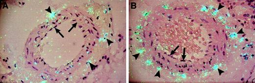 Fig. 3. Cellular distribution of TF mRNA in an artery in the perinephric fat from lean and obese (ob/ob) mice. / In situ hybridization was performed on paraffin-embedded perinephric fat from lean (A) and obese (B) mice using 35S-labeled TF riboprobes, as described in “Materials and methods.” Arrowheads indicate examples of positive hybridization signals, and arrows show the absence of hybridization signal in endothelial cells. Slides were exposed for 4 weeks at 4°C and stained with hematoxylin and eosin. Original magnification is × 400 for both sections.