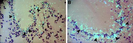 Fig. 5. Effect of insulin on the cellular distribution of TF mRNA in the lungs of lean mice. / In situ hybridization was performed on paraffin sections from the lungs of untreated (A) and insulin-treated (Himulin, 10 U; 6 hours) (B) lean (C57BL/6J) mice. Slides were exposed for 4 weeks at 4°C and stained with hematoxylin and eosin. Arrowheads indicate positive cells. Original magnification is × 400 for both sections.