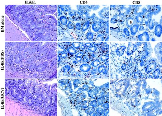 Fig. 2. Histopathology and immunohistochemistry of intestine. / Tissue was prepared as described in “Materials and methods.” For immunohistochemistry, sections were stained with biotin-labeled rat monoclonal antibodies to either CD4 or CD8, followed by streptavidin-conjugated horseradish peroxidase and development with 3-AEC. Sections were counterstained with hematoxylin. Note on H&E-stained sections the massive inflammatory infiltration and isolated apoptotic cells in the IL-4-tk splenocyte recipient treated with PBS, which had GVHD. IL-4-tk splenocyte recipients treated with GCV and BM controls appeared normal. Immunohistochemistry revealed many more CD4+ and CD8+ cells in the IL-4-tk splenocyte recipient treated with PBS compared with a similar mouse treated with GCV or that received BM alone. Apparent magnification × 250.
