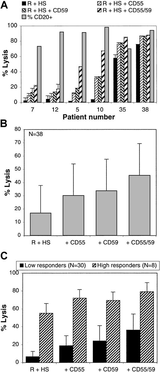 Fig. 5. CD55 and CD59 block rituximab and complement-mediated lysis. / PBMCs from 33 patients with B-CLL and 5 patients with PLL were lysed with rituximab and 25% human serum in the presence or absence of blocking anti-CD55 and/or anti-CD59 antibodies (10 μg/mL). Lysis was measured after 4 hours with the Alamar blue assay. (A) The mean and SDs obtained with 6 different representative patients are shown. (B) The mean lysis and SDs for all 38 patients are shown. (C) The mean lysis of the 30 low responders (basal lysis less than 25%; black bars) and of the 8 high responders (basal lysis greater than 30%; hatched bars) and SDs are shown.