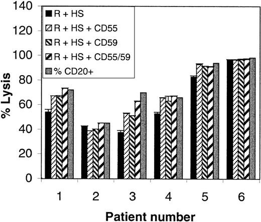 Fig. 7. Rituximab and complement-mediated lysis of MCLs. / PBMCs from 6 cases of MCL were lysed with rituximab and 25% human serum (black bars) in the presence or absence of blocking anti-CD55 and/or anti-CD59 antibodies (10 μg/mL; hatched bars). Lysis was measured with the Alamar blue assay. The percentage CD20+cells in each sample is also shown (gray bars).