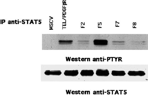 Fig. 3. Phosphorylation of STAT5 by TEL/PDGFβR in Ba/F3 cells. / Ba/F3 cells that express TEL/PDGFβR were lysed and immunoprecipitated with antibody against STAT5. The immune complex was probed with either 4G10 antiphosphotyrosine (anti-PTYR) antibody (top) or anti-STAT5 antibody (bottom).