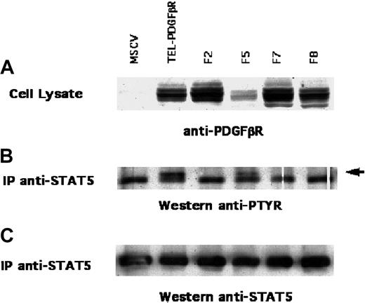Fig. 4. STAT5 phosphorylation in 32D cells. / (A) 32D myeloid cells that expressed TEL/PDGFβR variants were lysed and immunoblotted with antibody against TEL/PDGFβR. (B) Cell lysates were also immunoprecipitated with antibody against STAT5 and immunoblotted with antibody against phosphotyrosine or (C) STAT5. Arrow indicates hyperphosphorylated STAT5.