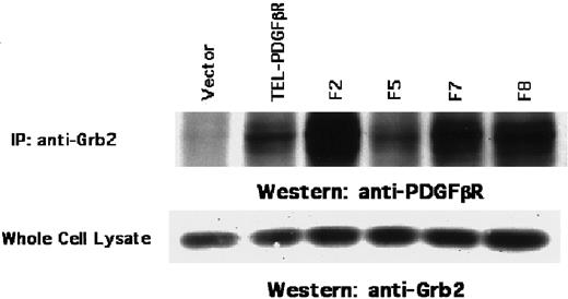 Fig. 8. Association of TEL/PDGFβR with the Grb2 adaptor protein. / Ba/F3 cell lysates were immunoprecipitated with antibody against Grb2 and immunoblotted with antibody against the PDGFβR cytoplasmic domain (top). Expression of Grb2 was determined in whole cell lysates by immunoblotting with antibody against Grb2 (bottom).