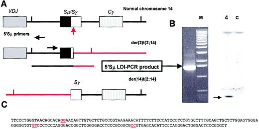 Fig. 1. Cloning of t(2;14)(p13;q32.3) breakpoint by 5′ Sμ LDI-PCR. / (A) Ideogram showing strategy used for LDI-PCR cloning of 5′ Sμ breakpoints. Top panel represents normal chromosome 14 with class-switched IGH VDJ fragment; middle panel, der(2)t(2;14)(p13;q32.3); and lower panel, der(14)t(2;14)(p13;q32.3). Class-switching results in 5′ Sμ sequences being retained whereas 3′ Sμ sequences are deleted. Most IGHS translocation breakpoints occur within switch regions that have already undergone class-switching, leaving the 5′ Sμ intact on the other derivative chromosome. These sequences can then be used to amplify the translocated allele using 5′ Sμ primers. Black horizontal lines represent chromosome 14; red lines, chromosome 2. The vertical red arrow represents the translocation breakpoint. Vertical lines representHindIII sites. (B) The left panel shows 1.6 kb LDI-PCR product obtained with 5′ Sμ primers; lane M denotes molecular weight markers. The right panel shows southern blot of DNA from patient 4 and DNA from a healthy individual (lane C) digested withHindIII and probed with a 5′ Sμ probe.34 An arrow points to a 2.1 kb rearranged band in patient 4. This was shown to be an illegitimate IGHS recombination event by reprobing with a 3′ Sμ probe (data not shown). Given the location of the DNA primers within 5′ Sμ this is the size of the LDI-PCR product anticipated from the southern blot results. (C) Location of translocation breakpoints within 2p13. Breakpoints derived from either bacteriophage cloning or LDI-PCR are shown in red. All 3 cloned breakpoints fell within 125 bp of each other.