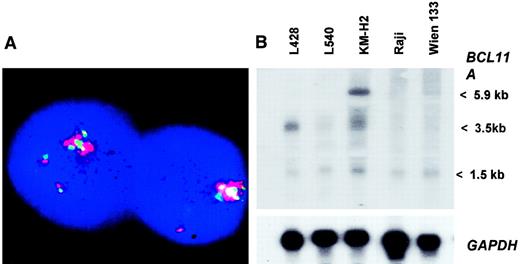 Fig. 7. BCL11A amplification and overexpression in Hodgkin and non-Hodgkin lymphoma. / (A) BCL11A amplification in a primary case of B-NHL. FISH with 2 pooled BCL11A-specific BACs RP11-440P05 and RP11-158I21 (green signal) and 2 pooled REL-specific YAC clones 747H5 and 927G9 (red signal) on interphase nuclei from a case of relapsed t(14;18)(q32.3;q21.3)–negative nodal follicular lymphoma showing coamplification of BCL11A and REL. Chromosome analysis revealed 2 abnormal chromosomes 2, add(2)(p14∼15) and der(1)t(1;2)(p11;p11)trp(2)(p12p13). (B) Northern blot analysis of malignant lymphoma cell lines. Burkitt lymphoma cell lines Wien 133 and Raji, and HD cell line L540, showed low-level BCL11Aexpression. HD cell lines L428 and KM-H2 showed overexpression ofBCL11A. In L428, this was predominantly ofBCL11AL, whereas in KM-H2 all 3 isoforms were expressed at similar levels.